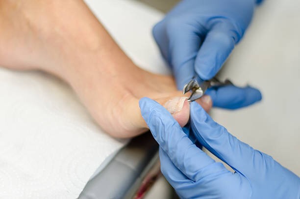 Podiatrist Glenroy
Podiatrist Coburg
Podiatrist Coburg north
Podiatrist 
Heel pain
Plantar fasciitis
Sports podiatrist
Ingrown toenail
warts
Corn
flat feet