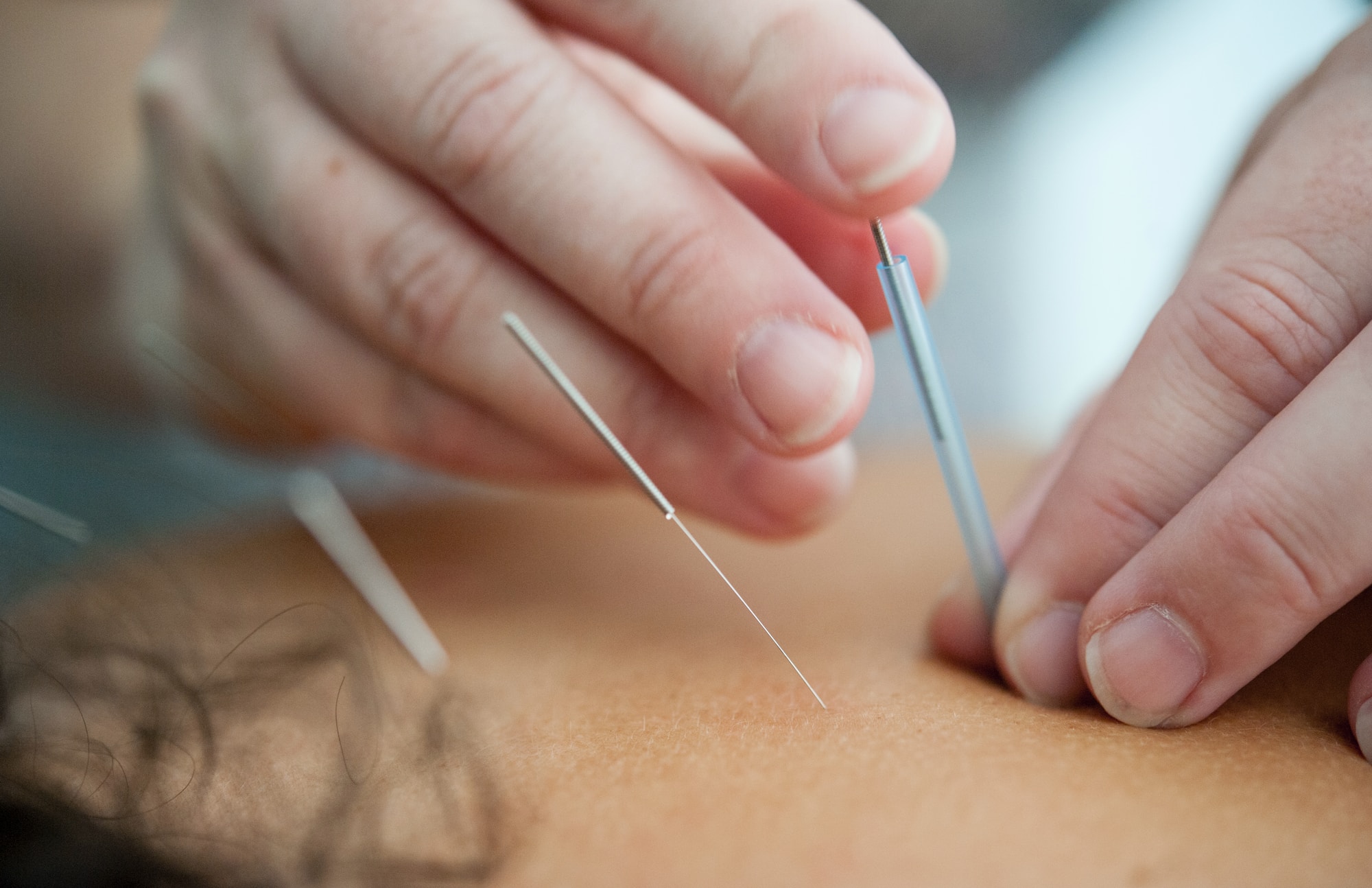 Podiatrist Glenroy
Podiatrist Coburg
Podiatrist Coburg north
Podiatrist 
Heel pain
Plantar fasciitis
Sports podiatrist
Ingrown toenail
warts
Corn
flat feet